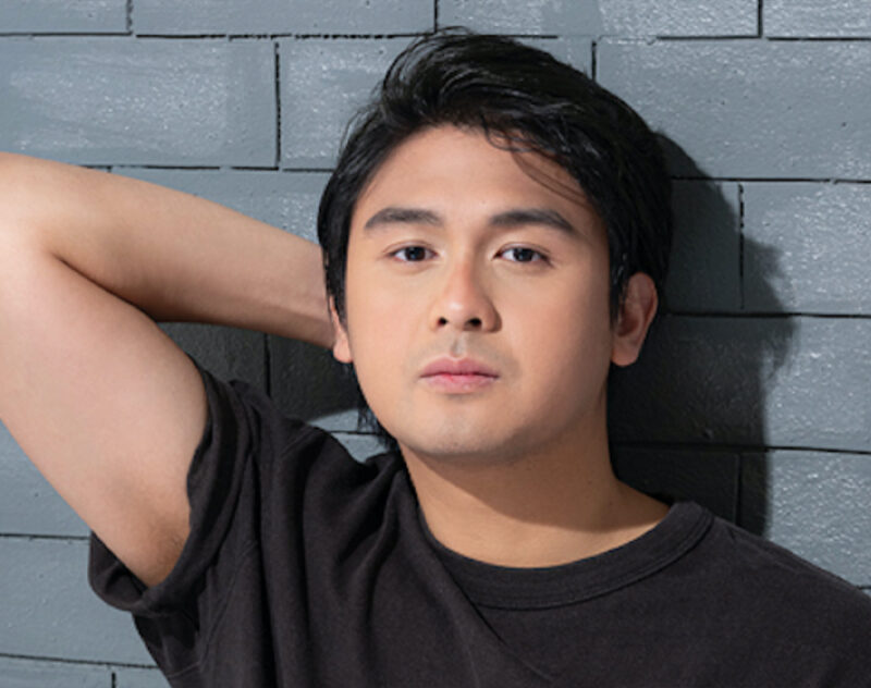 LOOK: Actor Paulo Angeles discovers revolutionary hair loss treatment ...